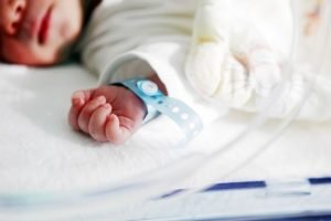 Mengenal Lebih Dekat Tentang Kondisi Patent Ductus Arteriosus Pada Bayi