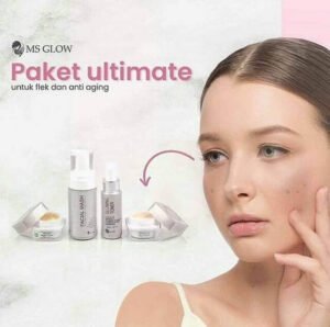Menghilangkan Flek Hitam Lebih Efektif dengan Paket Perawatan MS Glow