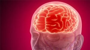 Sumbatan Darah di Otak Bisa Mematikan