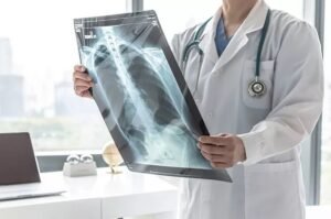 Jenis Rokok Berbeda, Beda Pula Letak Kankernya